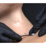 ALISSIMED POWDERFUL Kwas kojowy, 5 x 4g - obrazek 2